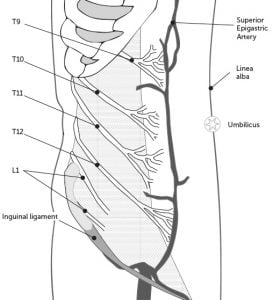 The Maylard incision: Setthathirath technique – O&G Magazine