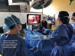 Ergonomics of laparoscopic surgery – O&G Magazine